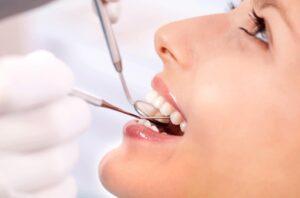 Read more about the article Чому та коли потрібно звертатись до ортодонта?